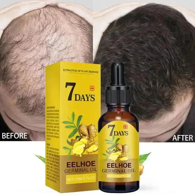 Ginger Hair Growth Serum Anti Hair loss Baldness Fast Regrowth Hair Care Oil Repair Damaged Hair Scalp Treatment For Women Men