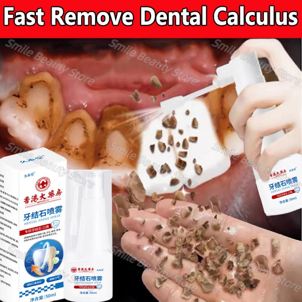 Removedor de cálculo Dental, blanqueamiento Dental en aerosol, pasta de dientes, limpieza, higiene bucal, eliminación de halitosis, manchas de placa, cuidado del aliento fresco