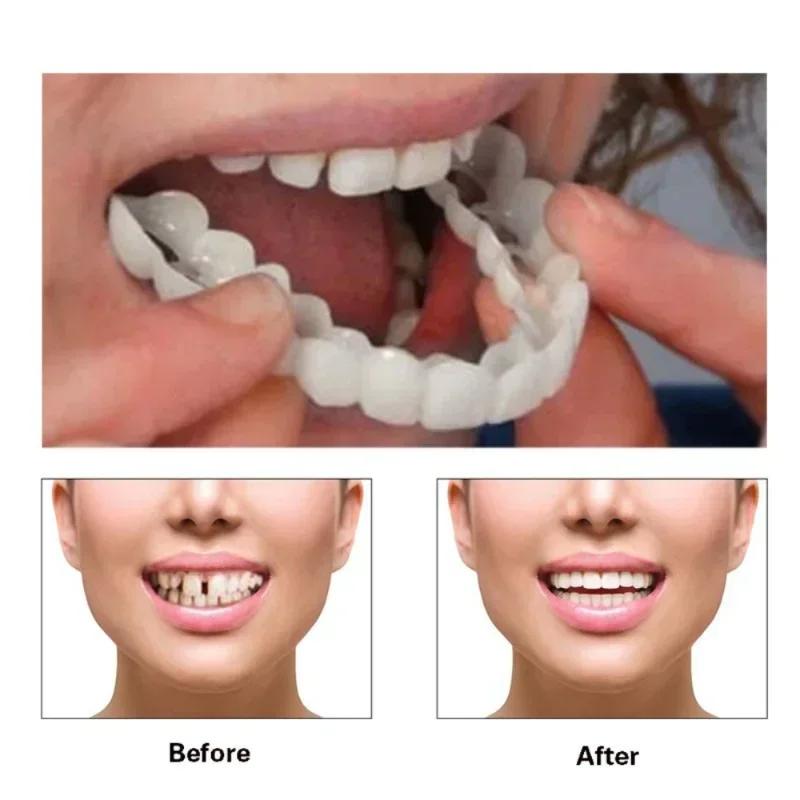 Juego completo de dentaduras postizas naturales, ajuste perfecto, blanqueamiento dental, presión en silicona, carillas de sonrisa instantánea, herramienta de belleza para dentadura