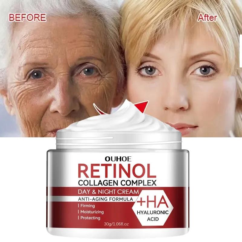 Retinol eliminador de arrugas crema facial reafirmante Lifting antienvejecimiento desvanecimiento líneas finas hidratante blanqueamiento reparación cosméticos para el cuidado de la piel